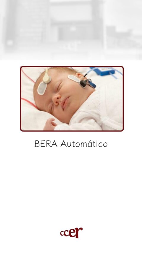 BERA Automático — CCER Anápolis
