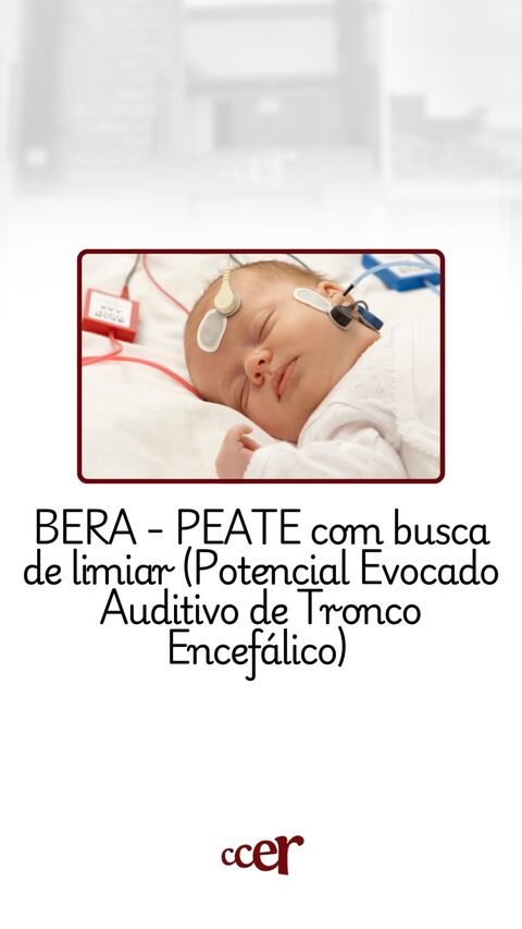 BERA — PEATE com busca de limiar — CCER Anápolis